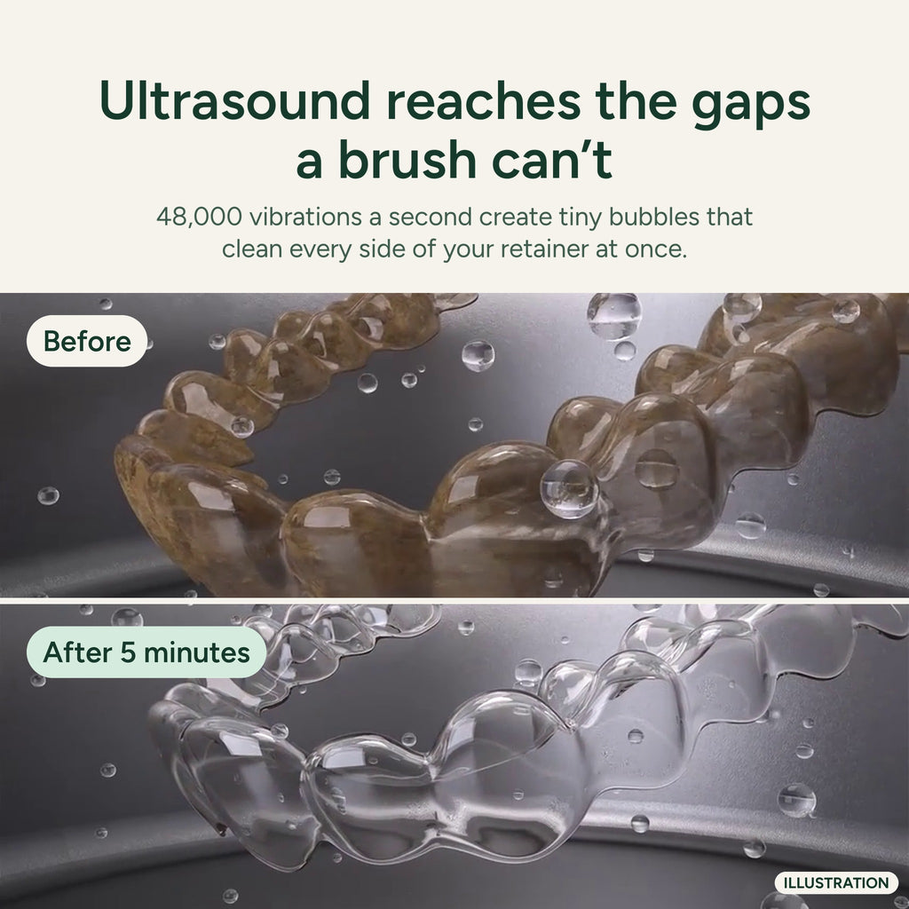 Ultrasonic Retainer Cleaner